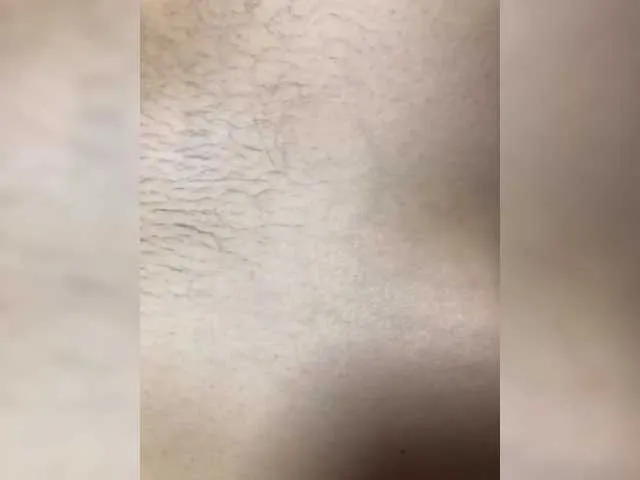 Nepolto's Thumb Image